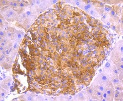 Invitrogen ASK1 Recombinant Rabbit Monoclonal Antibody (SU36-06) 100 &mu;L;