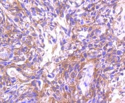 Invitrogen ASK1 Recombinant Rabbit Monoclonal Antibody (SU36-06) 100 &mu;L;