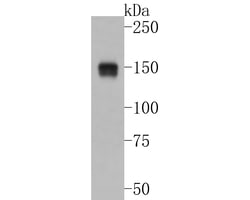 Invitrogen ASK1 Recombinant Rabbit Monoclonal Antibody (SU36-06) 100 &mu;L;