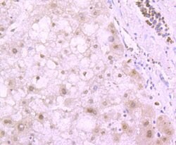 Invitrogen H4K20me3 Recombinant Rabbit Monoclonal Antibody (ST044-07) 100