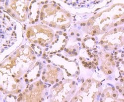 Invitrogen H4K20me3 Recombinant Rabbit Monoclonal Antibody (ST044-07) 100