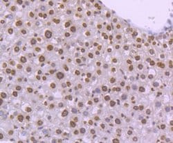Invitrogen H4K20me3 Recombinant Rabbit Monoclonal Antibody (ST044-07) 100