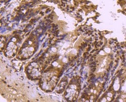 Invitrogen H4K20me3 Recombinant Rabbit Monoclonal Antibody (ST044-07) 100