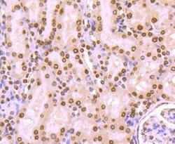 Invitrogen H4K20me3 Recombinant Rabbit Monoclonal Antibody (ST044-07) 100