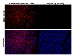 Invitrogen CD117 (c-Kit) Recombinant Rabbit Monoclonal Antibody (ST04-99)