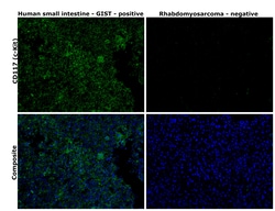 Invitrogen CD117 (c-Kit) Recombinant Rabbit Monoclonal Antibody (ST04-99)