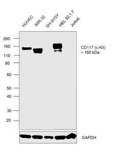 Invitrogen CD117 (c-Kit) Recombinant Rabbit Monoclonal Antibody (ST04-99)