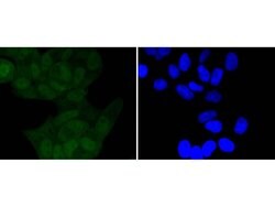 Invitrogen Phospho-IkB alpha (Ser32) Recombinant Rabbit Monoclonal Antibody (ST53-05) 100 &mu;L | Buy Online | Invitrogen&trade; | Fisher Scientific