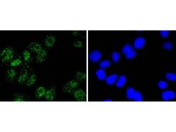 Invitrogen NBS1 Recombinant Rabbit Monoclonal Antibody (SC05-68) 100 &mu;L;