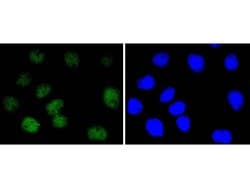 Invitrogen NBS1 Recombinant Rabbit Monoclonal Antibody (SC05-68) 100 &mu;L;