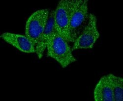 Invitrogen PYK2 Recombinant Rabbit Monoclonal Antibody (SC06-15) 100 &mu;L;