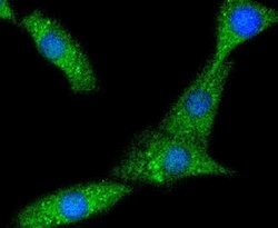 Invitrogen PYK2 Recombinant Rabbit Monoclonal Antibody (SC06-15) 100 &mu;L;