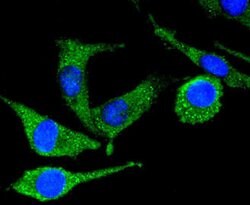 Invitrogen PYK2 Recombinant Rabbit Monoclonal Antibody (SC06-15) 100 &mu;L;