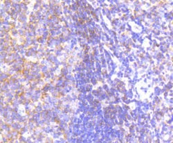 Invitrogen PYK2 Recombinant Rabbit Monoclonal Antibody (SC06-15) 100 &mu;L;