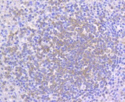 Invitrogen PYK2 Recombinant Rabbit Monoclonal Antibody (SC06-15) 100 &mu;L;