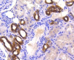 Invitrogen PYK2 Recombinant Rabbit Monoclonal Antibody (SC06-15) 100 &mu;L;