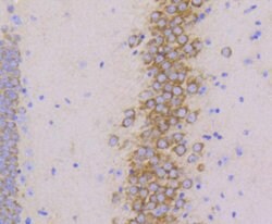 Invitrogen PYK2 Recombinant Rabbit Monoclonal Antibody (SC06-15) 100 &mu;L;