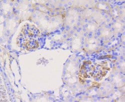 Invitrogen PYK2 Recombinant Rabbit Monoclonal Antibody (SC06-15) 100 &mu;L;