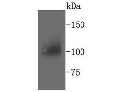 Invitrogen PYK2 Recombinant Rabbit Monoclonal Antibody (SC06-15) 100 &mu;L;