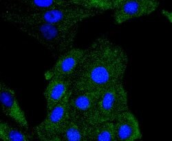 Invitrogen Phospho-PDGFRB (Tyr740) Recombinant Rabbit Monoclonal Antibody (SN0646) 100 &mu;L | Buy Online | Invitrogen&trade; | Fisher Scientific