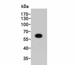 Invitrogen HA Tag Recombinant Rabbit Monoclonal Antibody (SN07-06) 100