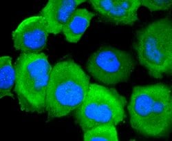 Invitrogen Phospho-EGFR (Ser695) Recombinant Rabbit Monoclonal Antibody