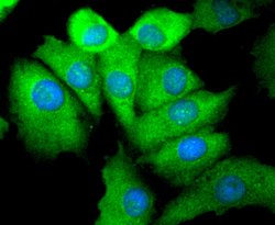 Invitrogen Phospho-EGFR (Ser695) Recombinant Rabbit Monoclonal Antibody