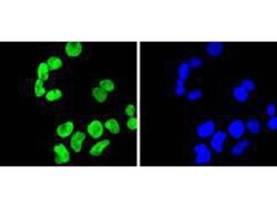 Invitrogen H3K9me2 Recombinant Rabbit Monoclonal Antibody (SN07-30) 100 &mu;L | Buy Online | Invitrogen&trade; | Fisher Scientific