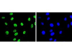 Invitrogen H3K9me2 Recombinant Rabbit Monoclonal Antibody (SN07-30) 100 &mu;L | Buy Online | Invitrogen&trade; | Fisher Scientific