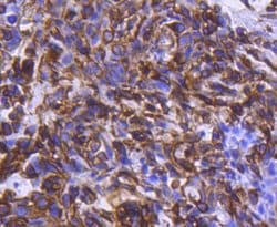 Invitrogen Phospho-Chk1 (Ser296) Recombinant Rabbit Monoclonal Antibody