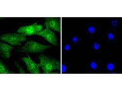 Invitrogen Cyclin E2 Recombinant Rabbit Monoclonal Antibody (SD2035) 100 &mu;L | Buy Online | Invitrogen&trade; | Fisher Scientific