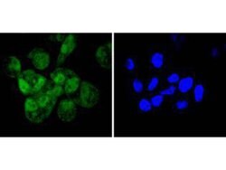 Invitrogen Cyclin E2 Recombinant Rabbit Monoclonal Antibody (SD2035) 100 &mu;L | Buy Online | Invitrogen&trade; | Fisher Scientific