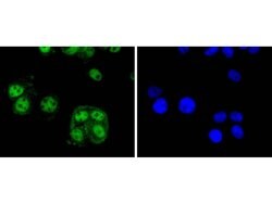 Invitrogen Cyclin E2 Recombinant Rabbit Monoclonal Antibody (SD2035) 100 &mu;L | Buy Online | Invitrogen&trade; | Fisher Scientific