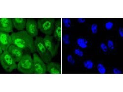 Invitrogen Phospho-EGFR (Tyr1068) Recombinant Rabbit Monoclonal Antibody
