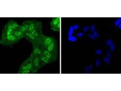 Invitrogen Phospho-EGFR (Tyr1068) Recombinant Rabbit Monoclonal Antibody