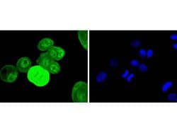 Invitrogen Phospho-EGFR (Tyr1068) Recombinant Rabbit Monoclonal Antibody
