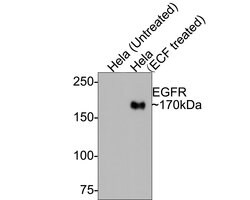 Invitrogen Phospho-EGFR (Tyr1068) Recombinant Rabbit Monoclonal Antibody