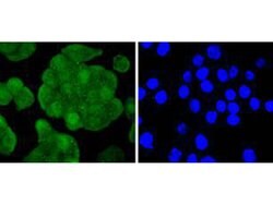 Invitrogen IRS1 Recombinant Rabbit Monoclonal Antibody (SD2046) 100 &mu;L;