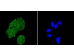 Invitrogen IRS1 Recombinant Rabbit Monoclonal Antibody (SD2046) 100 &mu;L;