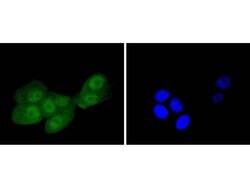 Invitrogen IRS1 Recombinant Rabbit Monoclonal Antibody (SD2046) 100 &mu;L;