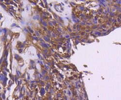 Invitrogen IRS1 Recombinant Rabbit Monoclonal Antibody (SD2046) 100 &mu;L;