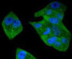 Invitrogen STAT5 beta Recombinant Rabbit Monoclonal Antibody (SD08-08)