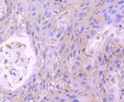 Invitrogen STAT5 beta Recombinant Rabbit Monoclonal Antibody (SD08-08)