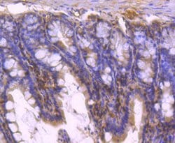 Invitrogen STAT5 beta Recombinant Rabbit Monoclonal Antibody (SD08-08)