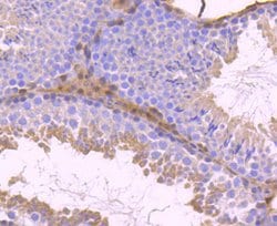 Invitrogen STAT5 beta Recombinant Rabbit Monoclonal Antibody (SD08-08)