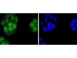 Invitrogen IRF2 Recombinant Rabbit Monoclonal Antibody (JJ088-0) 100 &mu;L;