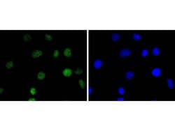 Invitrogen IRF2 Recombinant Rabbit Monoclonal Antibody (JJ088-0) 100 &mu;L;