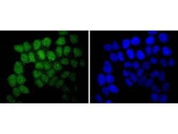 Invitrogen SUZ12 Recombinant Rabbit Monoclonal Antibody (JJ09-04) 100 &mu;L;