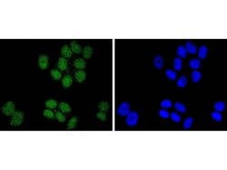 Invitrogen SUZ12 Recombinant Rabbit Monoclonal Antibody (JJ09-04) 100 &mu;L;