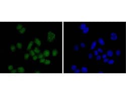 Invitrogen SUZ12 Recombinant Rabbit Monoclonal Antibody (JJ09-04) 100 &mu;L;